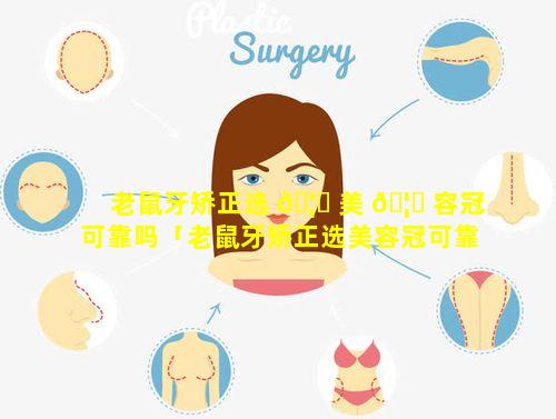 老鼠牙矫正选 🦄 美 🦍 容冠可靠吗「老鼠牙矫正选美容冠可靠吗安全吗」